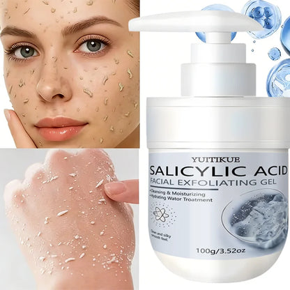 YUITIKUE Salicylic Acid Exfoliating Gel - Gentle Cleansing &amp; Moisturizing, Removes Dead Skin for Face &amp; Body, 100g